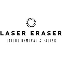 Laser Eraser: Laser Tattoo Removal