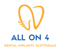 All-on-4 Dental Implants Scottsdale