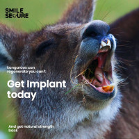 SmileSecure - Get premium dental services and Expert dentists near me at affordable prices