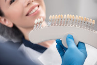 Dental veeners in Islamabad