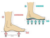 ProFunction Orthotics Near Me