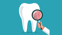 Best Implant Dentist in Duluth, GA | Nukoa Family Dentistry