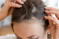 Best Hair Transplant in Riyadh
