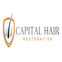 Capital Hair Restoration
