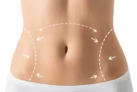 Tummy Tuck in Islamabad