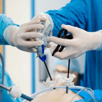Best laparoscopic in Islamabad Pakistan