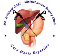 Dr. Anupam Goel, the top Laparoscopic Surgeon in Chandigarh