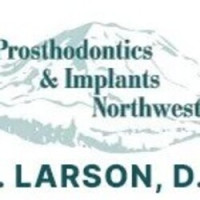 Top-Quality Dental Implants in Puyallup, WA | Kim E. Larson, DDS