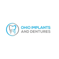 Ohio Implants and Dentures