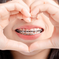 Metal Braces Treatment in Chelsea | Expert Orthodontic Care