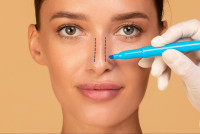 Rhinoplasty in Riyadh