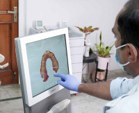 Best Dentist in West Delhi